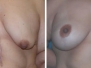 Dr. Camille Cash, Houston Breast Lifts